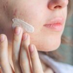 Skincare yang Mengandung Bahan Alami dan Ampuh Atasi Bekas Jerawat